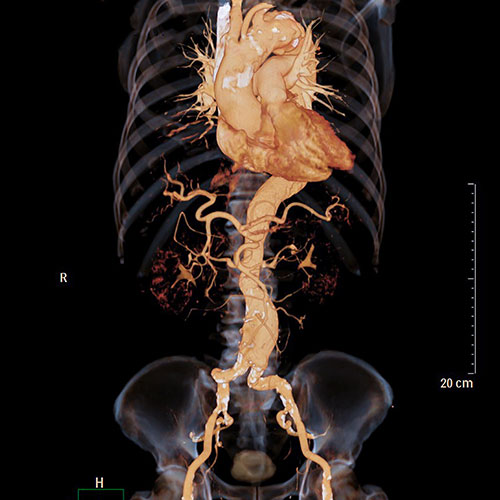 Computed Tomography Services at Imaging Healthcare Specialists in San Diego