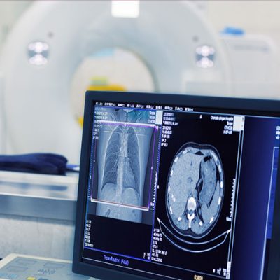 PET/CT - Imaging Healthcare Specialists