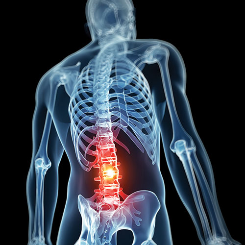 spine fracture treatments in San Diego