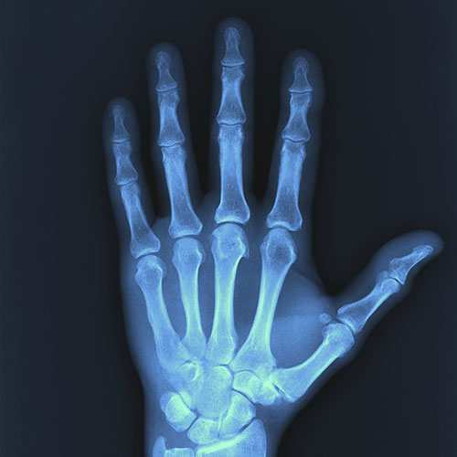 x-ray services throughout San Diego - x ray of hand