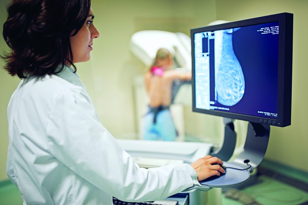 Women's Imaging Services in San Diego - Mammogram on screen